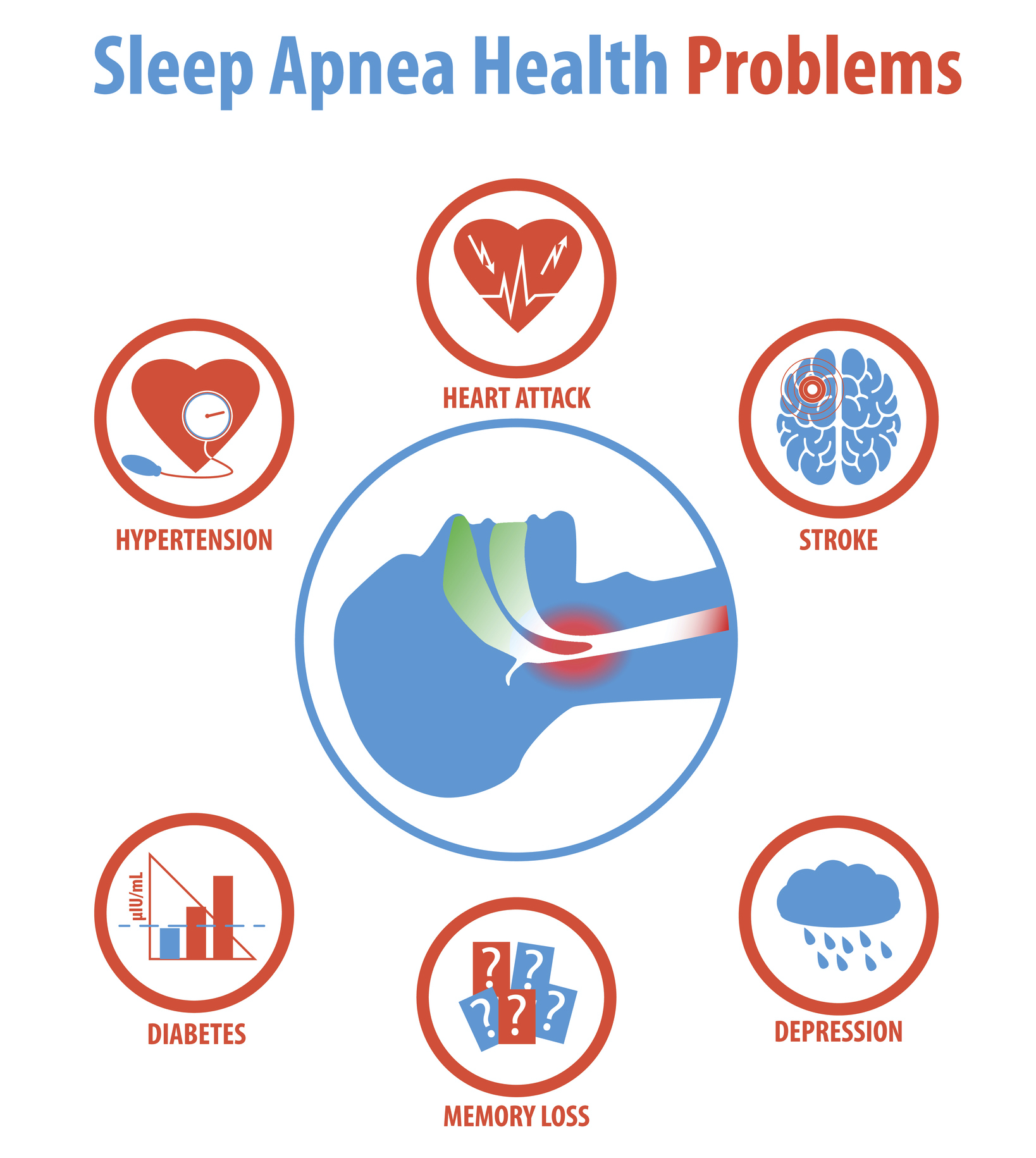 Sleep apnea: treatments, causes, symptoms and health problems. Vector Illustration.