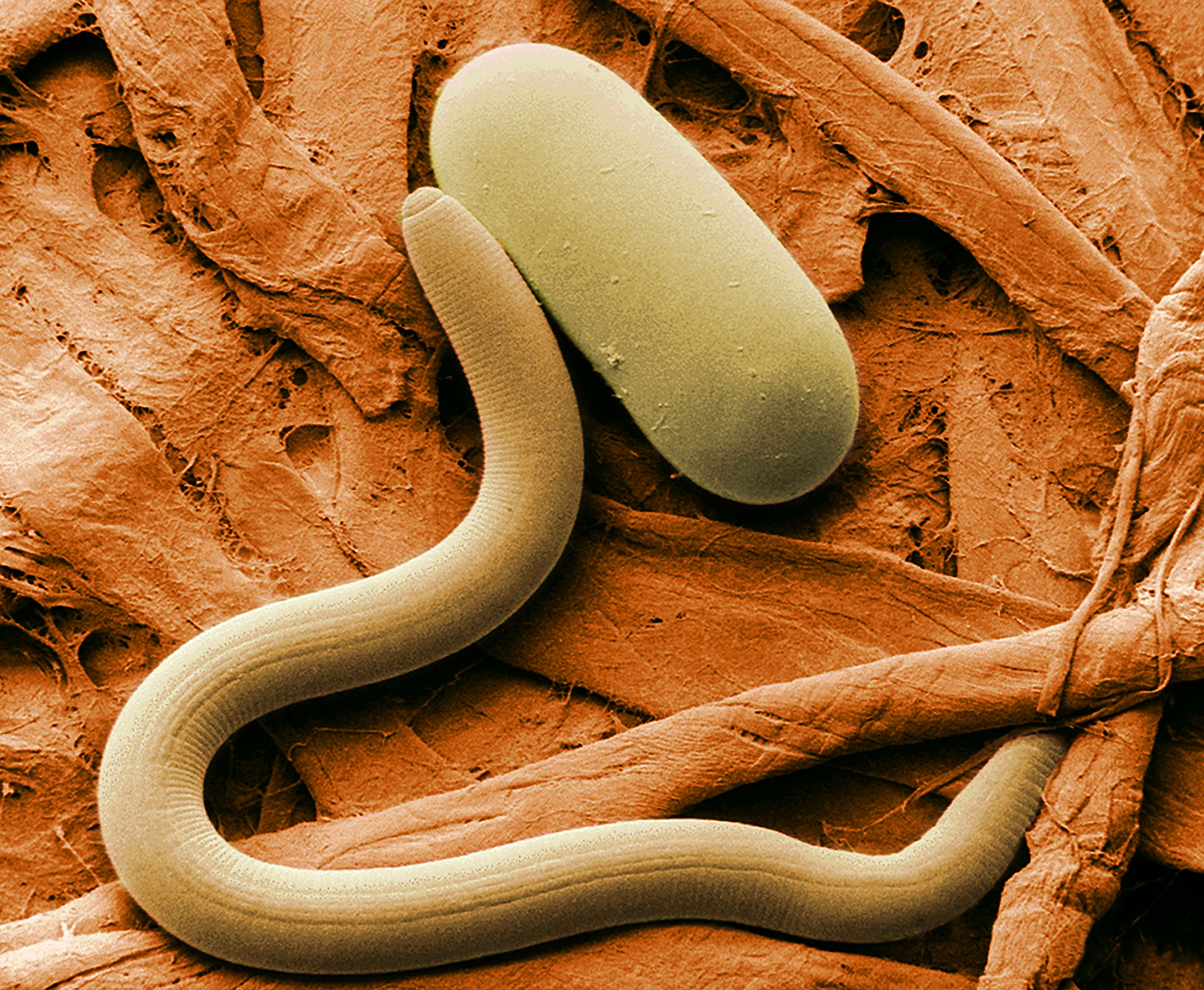 Soybean_cyst_nematode_and_egg_SEM